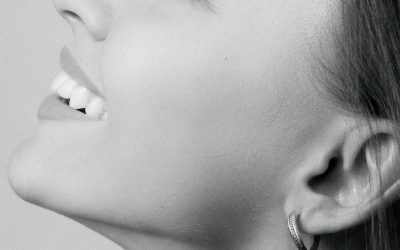 Geef je huid een collageenboost met Radiesse